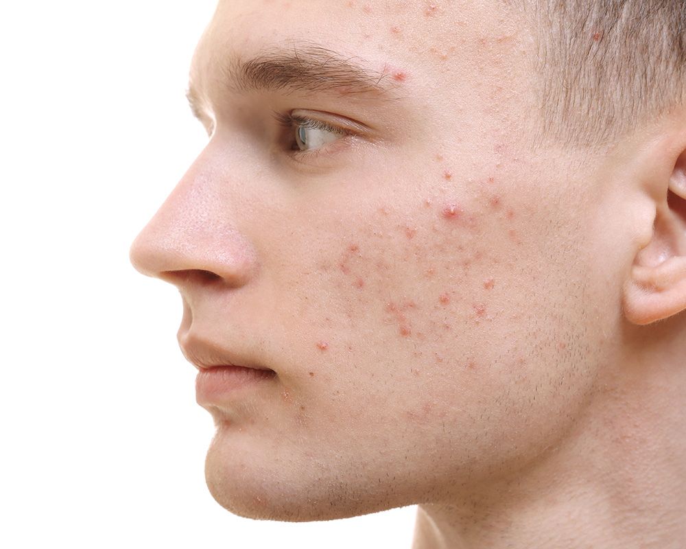 Allgemeine Dermatologie